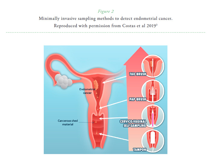 cancer endometrial papanicolau